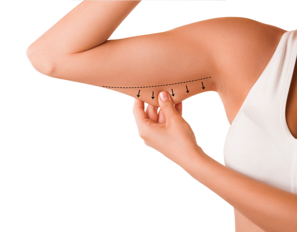 spa montreal body contouring spa montreal lipo cavitation body contouring under arm treatment before after client 1