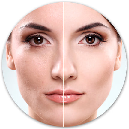 body contouring spa montreal facelift montreal before after pic