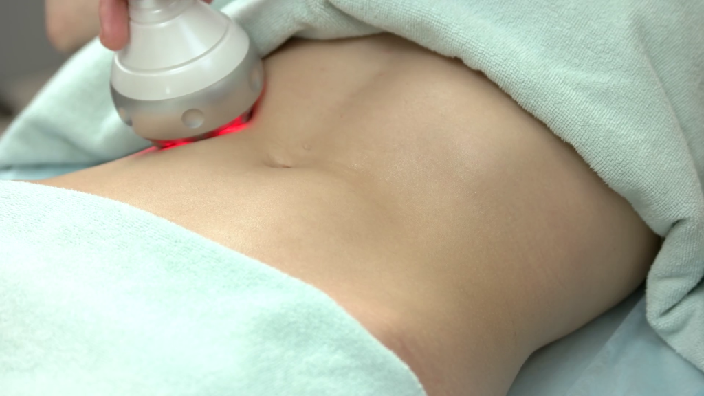body contouring spa montreal rf belly skin tightening