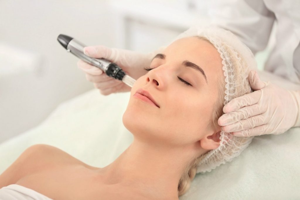 microneedling body contouring spa montreal technician using dermapen on customer face 2